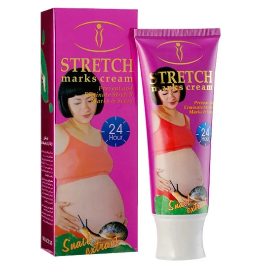 Aichun Beauty stretch marks removal Cream