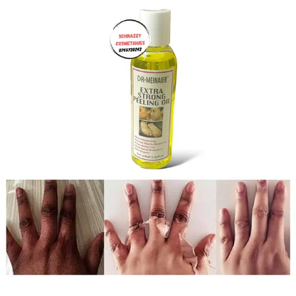 DR.MEINAIER Peeling Oil Whitening Peeling Oil Lighten Elbows Knees Hands Melanin Even Skin Tone and Whiten Skin