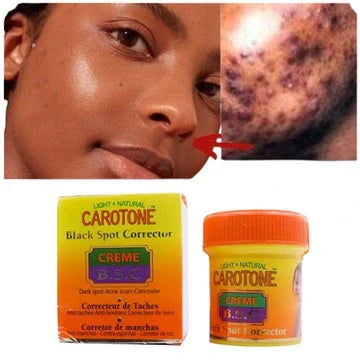 Carotone Light And Natural Dark Spot Corrector Acne Scars Concealer - 30ml