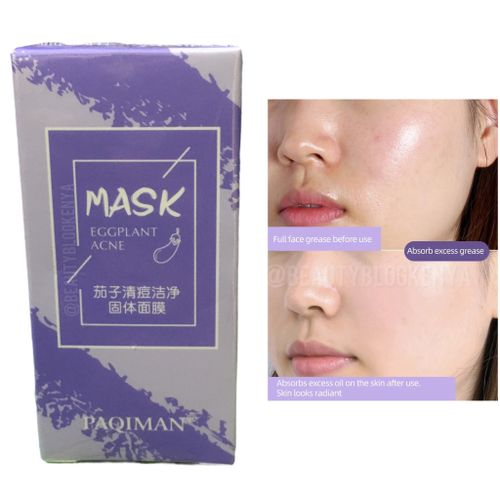 Stick Eggplant Acne Mask Stick Blackhead Pore Blemish Soothe Hydrate