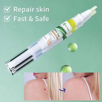 Sauvasine Skin Tag Remover & Wart Remover Lotion