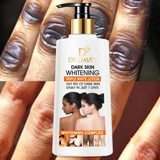 Dr. Davey Dark Skin Whitening Triple White Lotion