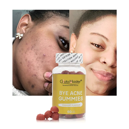 Gluta Master Bye Acne Gummies