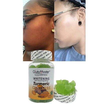 Gluta Master Whitening Turmeric Gummies