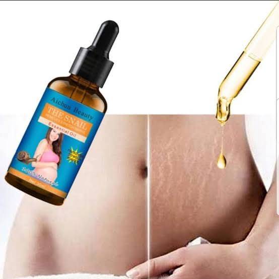 Aichun Beauty Stretch Marks Remover Essential Oil Skin Care 30ML