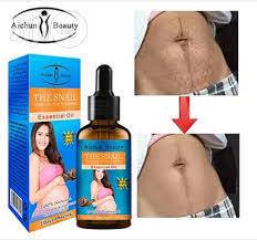 Aichun Beauty Stretch Marks Remover Essential Oil Skin Care 30ML