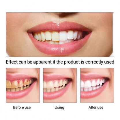 LANBENA professional teeth whitening essence liquid